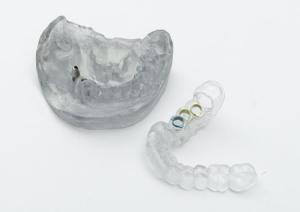 Molde dental
